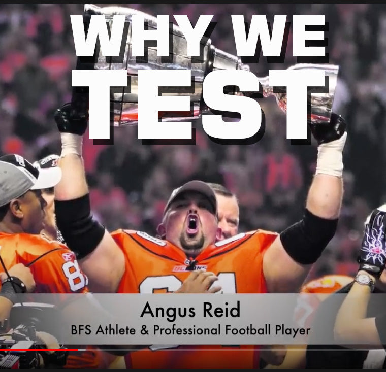 Why We Test